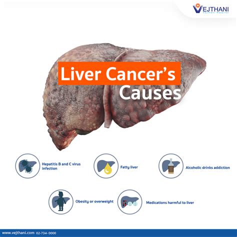 What Cause Cancer Of The Liver